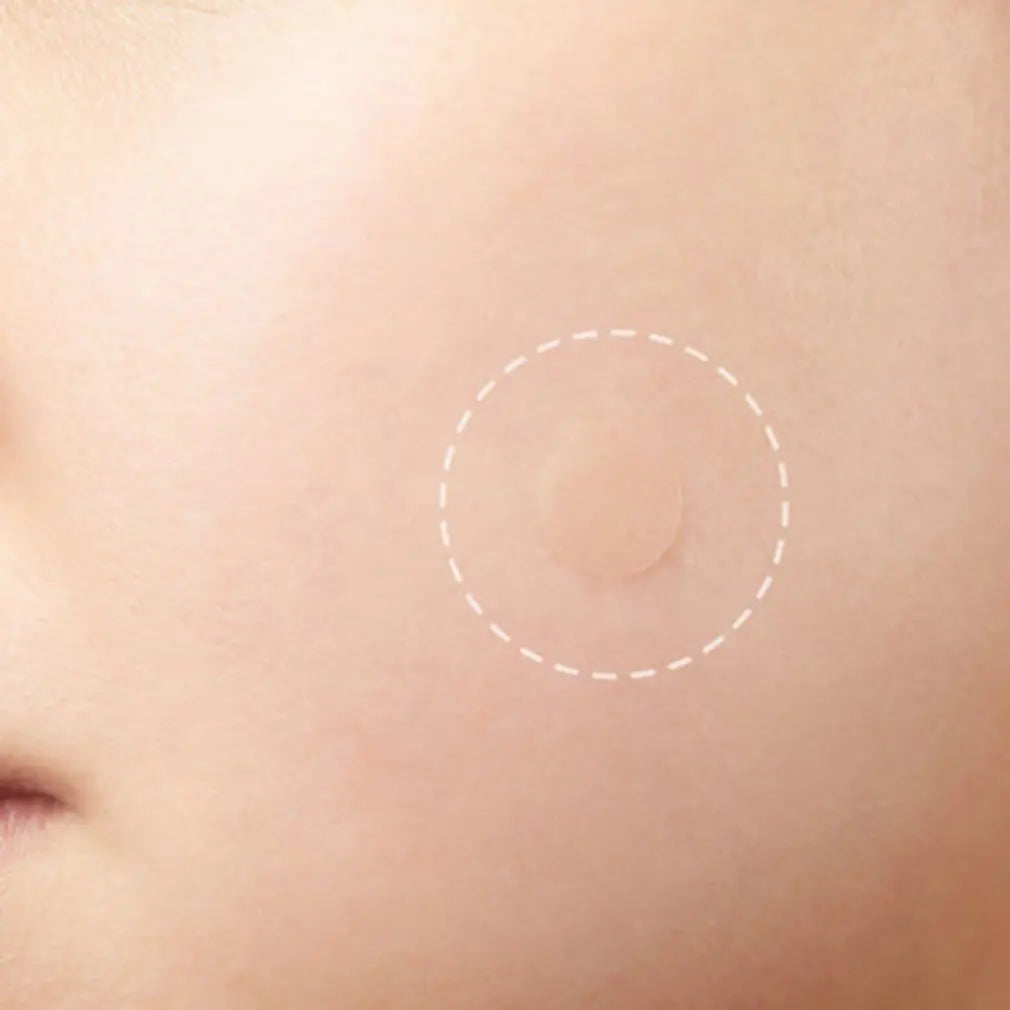 24 Hydrocolloid Invisible Pimple Patches
