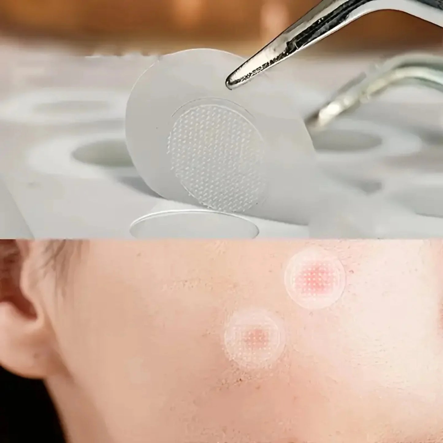 24pcs Daytime Hydrocolloid Acne Patches