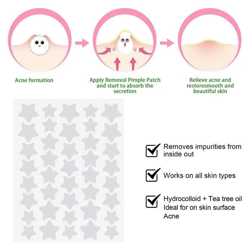 Colorful Star Pimple Patches (40)